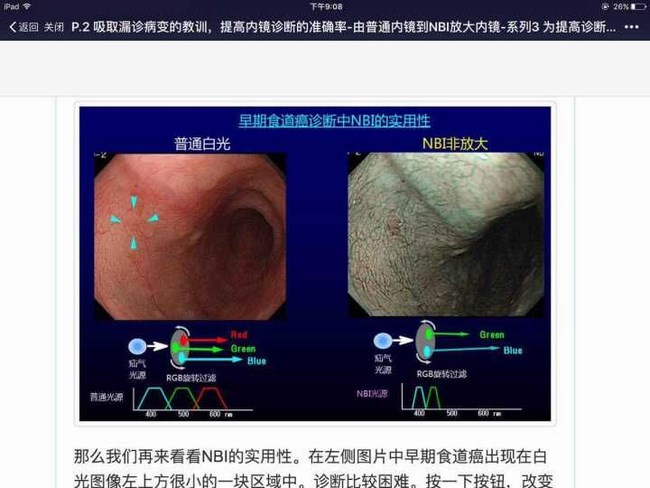 國際一流胃腸內窺鏡系統(tǒng)助力我院鏡診療水平更上新的臺階(圖1)