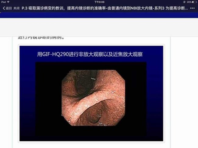 國際一流胃腸內窺鏡系統(tǒng)助力我院鏡診療水平更上新的臺階(圖2)