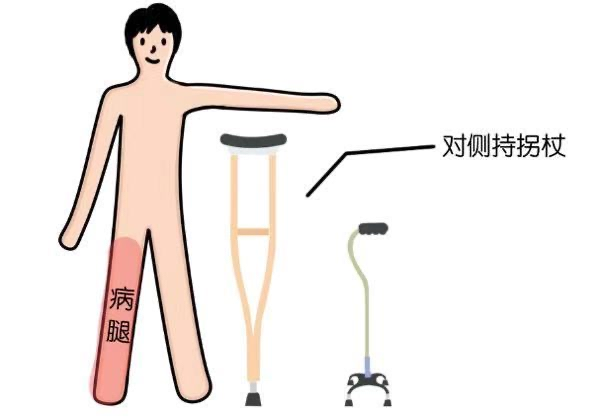 拐杖的“左右為難”——您會正確使用拐杖嗎？(圖2)