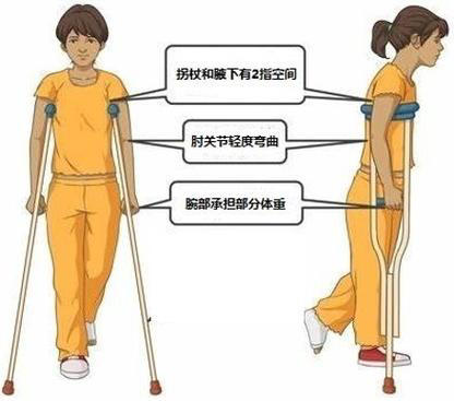拐杖的“左右為難”——您會正確使用拐杖嗎？(圖4)
