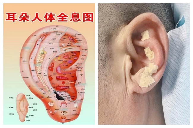 護(hù)理拼2 (Copy).jpg